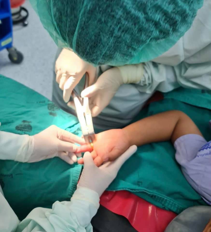 อุทาหรณ์! ยายรับขวัญหลาน 3 ขวบ ใส่แหวนทองให้สุดท้ายถอดไม่ออกต้องผ่าตัด