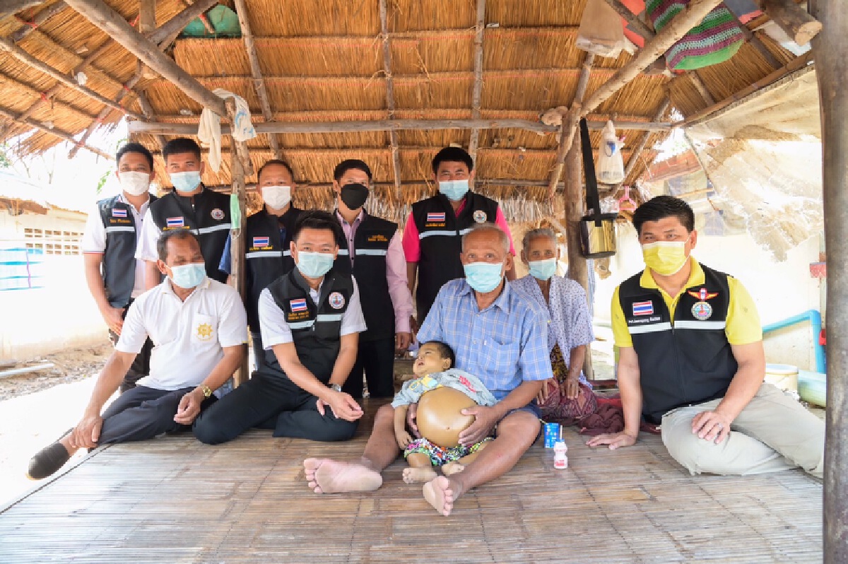 เด็กชายท้องโตถูกส่งรพ.ศิริราชหวังปลูกถ่ายตับ