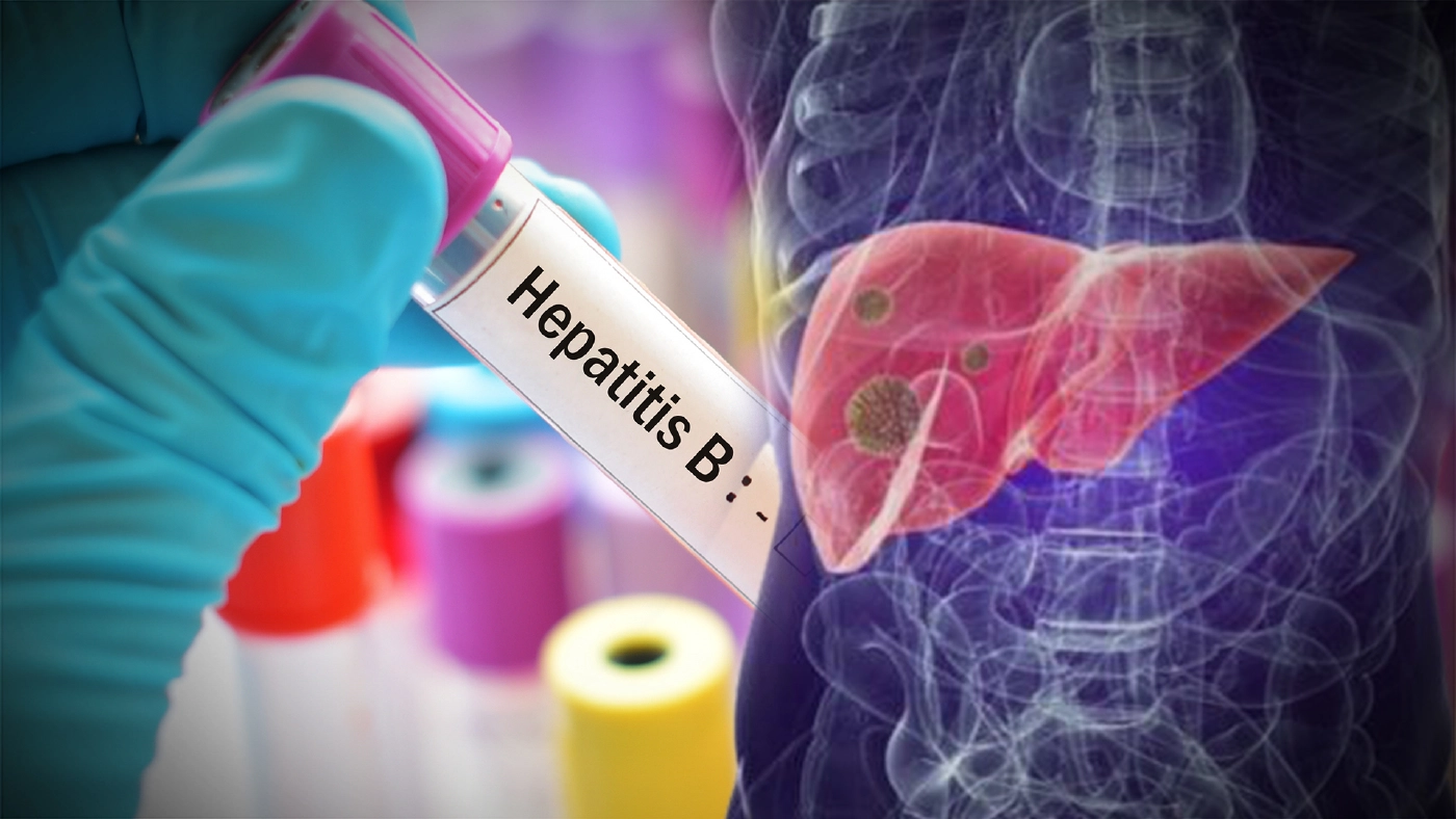 ไวรัสตับอักเสบบี ภัยร้ายใกลัตัว คร.เน้นให้ความรู้ ปชช. หวังยุติโรคใน 9 ปี