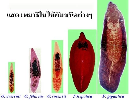 กรมอนามัย เตือน! กินปูสดๆเสี่ยงพยาธิ แนะปรุงสุก