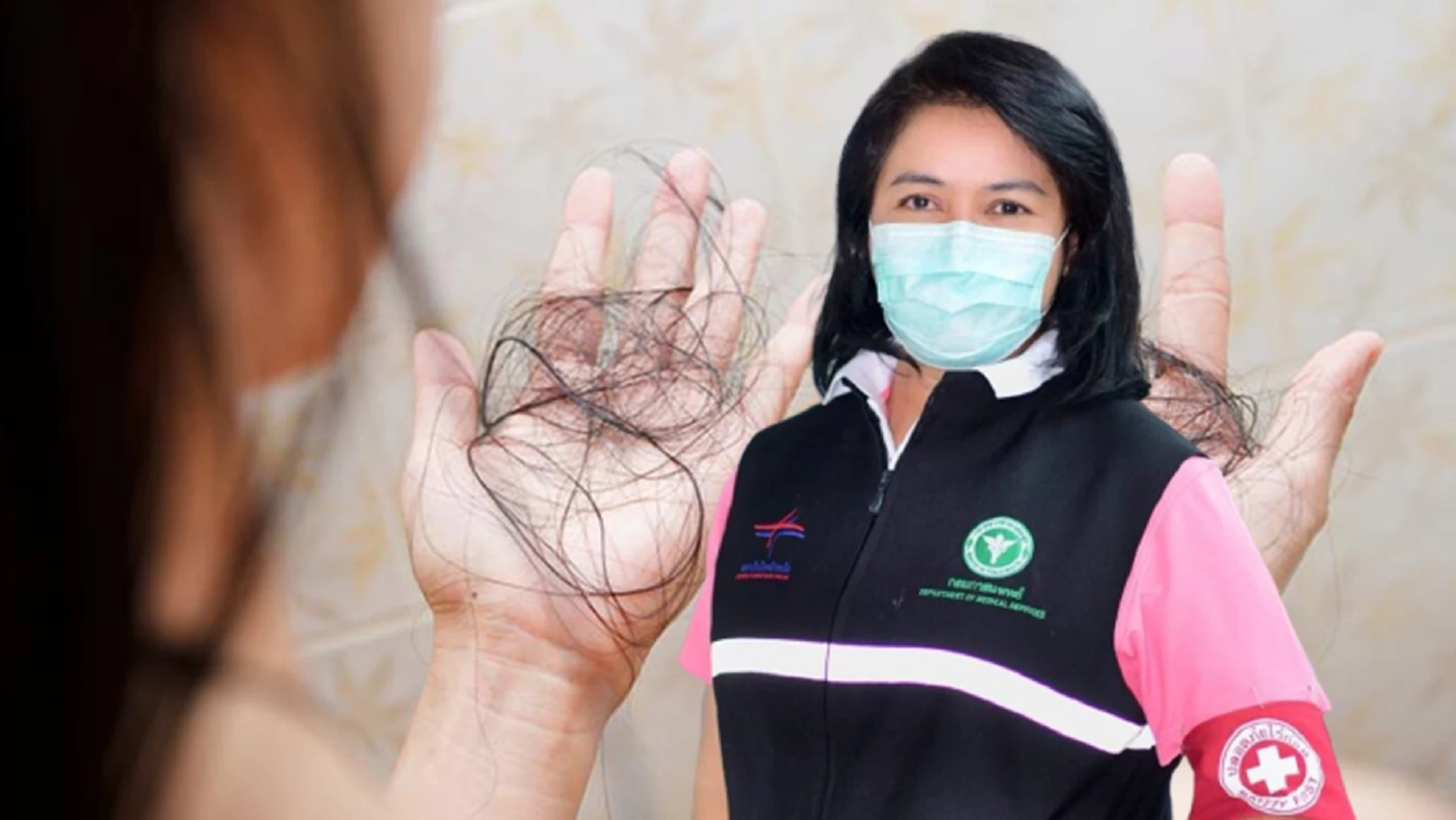 แพทย์ชี้ “ภาวะผมร่วงเป็นหย่อม” เกิดได้หลังฉีดวัคซีนโควิด 19