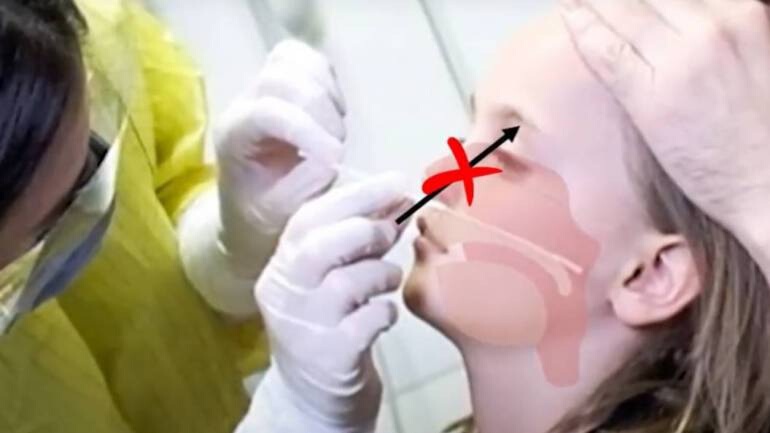 หมอศิริราชแนะ ตรวจ ATK ให้เด็กเรียน on-site เลือกใช้แบบน้ำลาย-swab จมูก