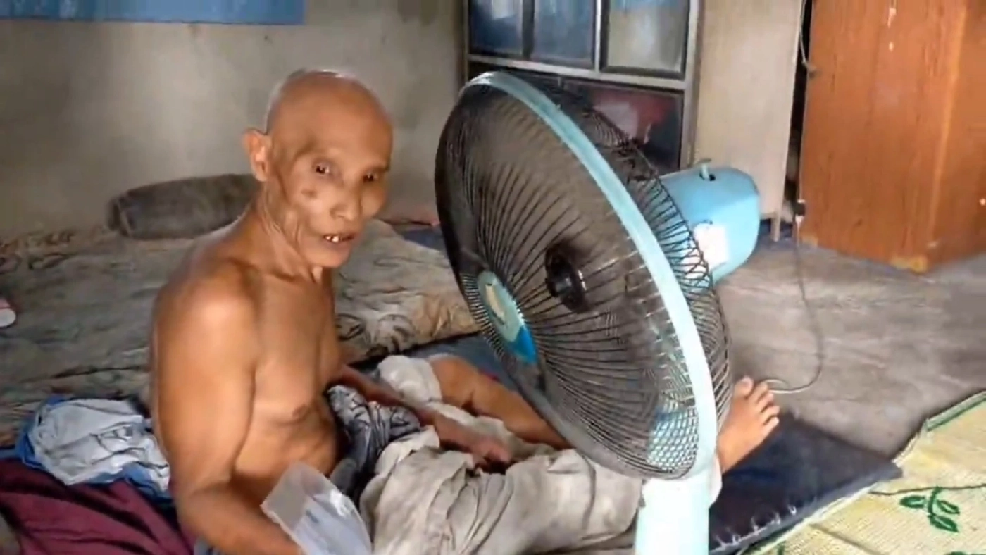 สุดดีใจ!ลุงป่วยติดเตียงนาน 4 ปี ฉีดแอสตร้าฯเข็มแรก ขาเริ่มขยับได้