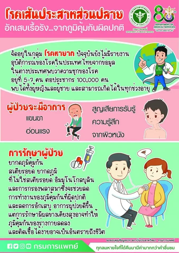 กรมการแพทย์เผย เส้นประสาทส่วนปลายอักเสบเรื้อรัง จากภูมิคุ้มกันผิดปกติ