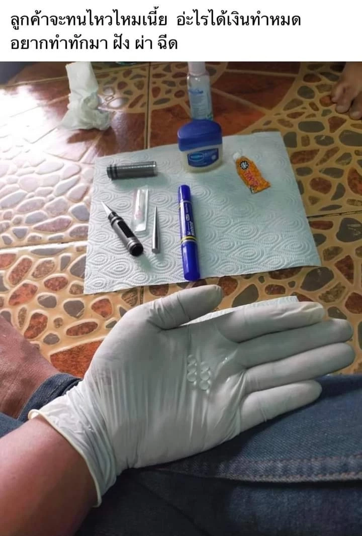 สนมั้ย! หนุ่มรีวิวโชว์ผลงานฝังผ่า "เพิ่มขนาด" ให้ลูกค้ากลัดมัน