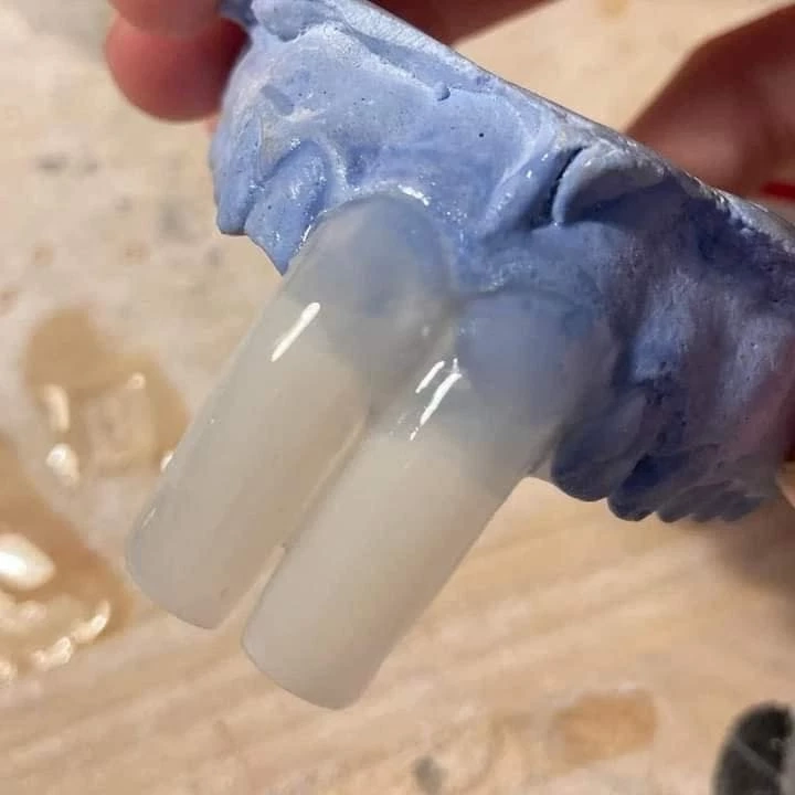 สาวไทยว่าไง! สวม "ฟันกระรอก" เทรนด์ใหม่ปี 2565