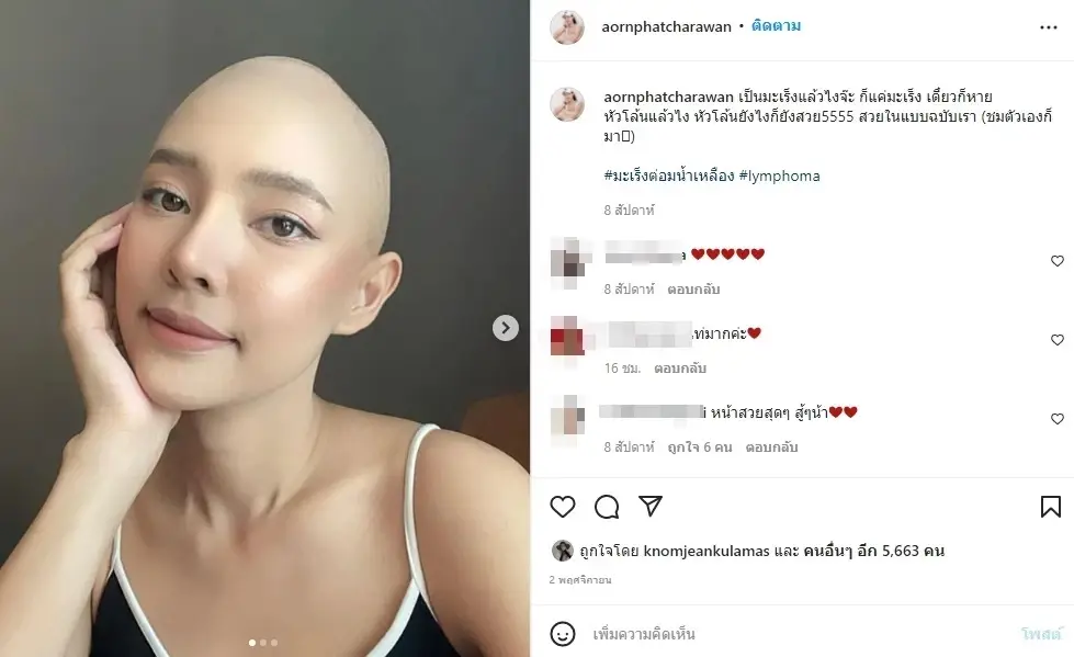 ส่งกำลังใจให้ “ออน พัชรวรรณ” รองนางสาวไทย หลังป่วยมะเร็งต่อมน้ำเหลือง