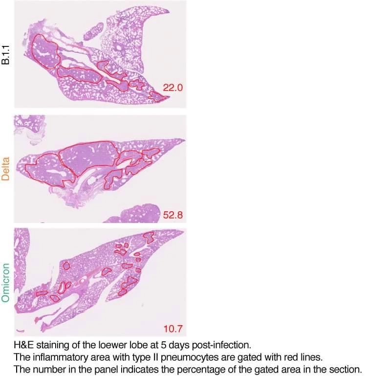 "ดร.อนันต์ "เปิดผลทดสอบ ATK 7 ยี่ห้อ ตรวจ "โอมิครอน" ได้