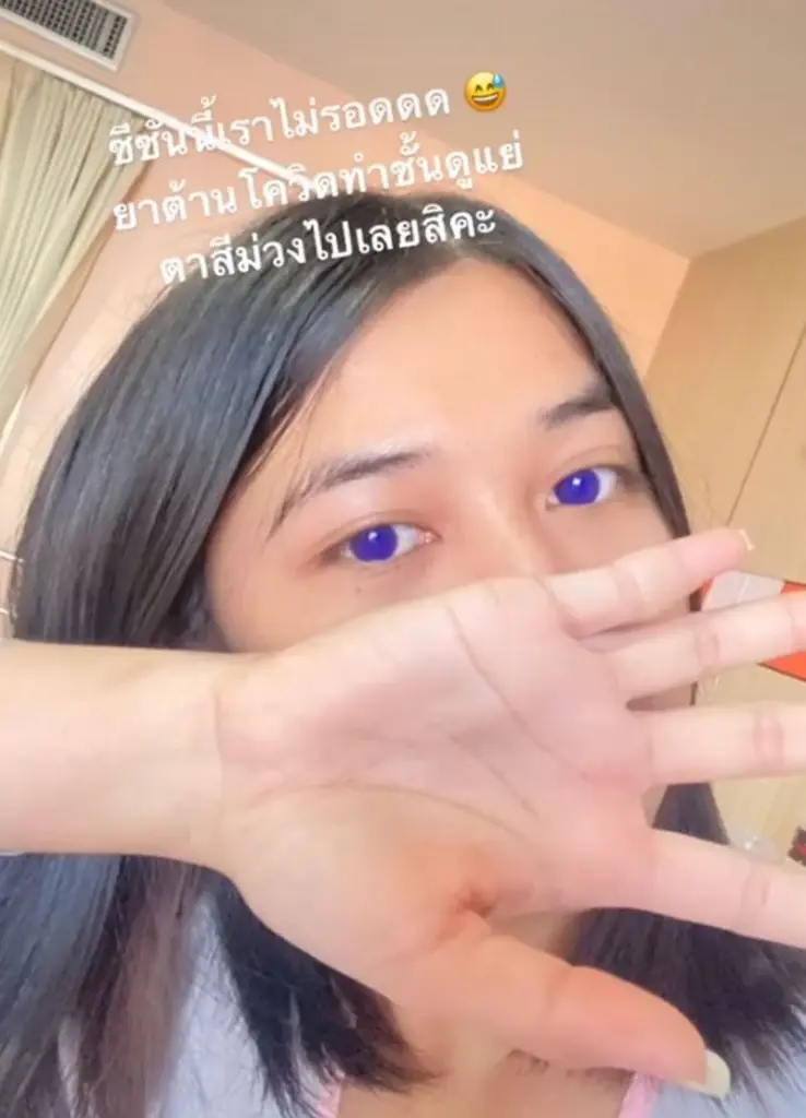 ฮือฮา! สาวโพสต์กินยาฟาวิพิราเวียร์แล้วตากลายเป็นสีม่วง