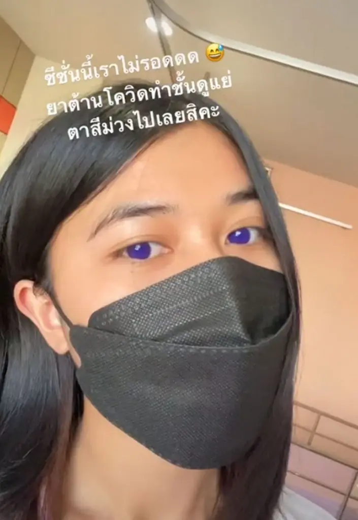 ฮือฮา! สาวโพสต์กินยาฟาวิพิราเวียร์แล้วตากลายเป็นสีม่วง
