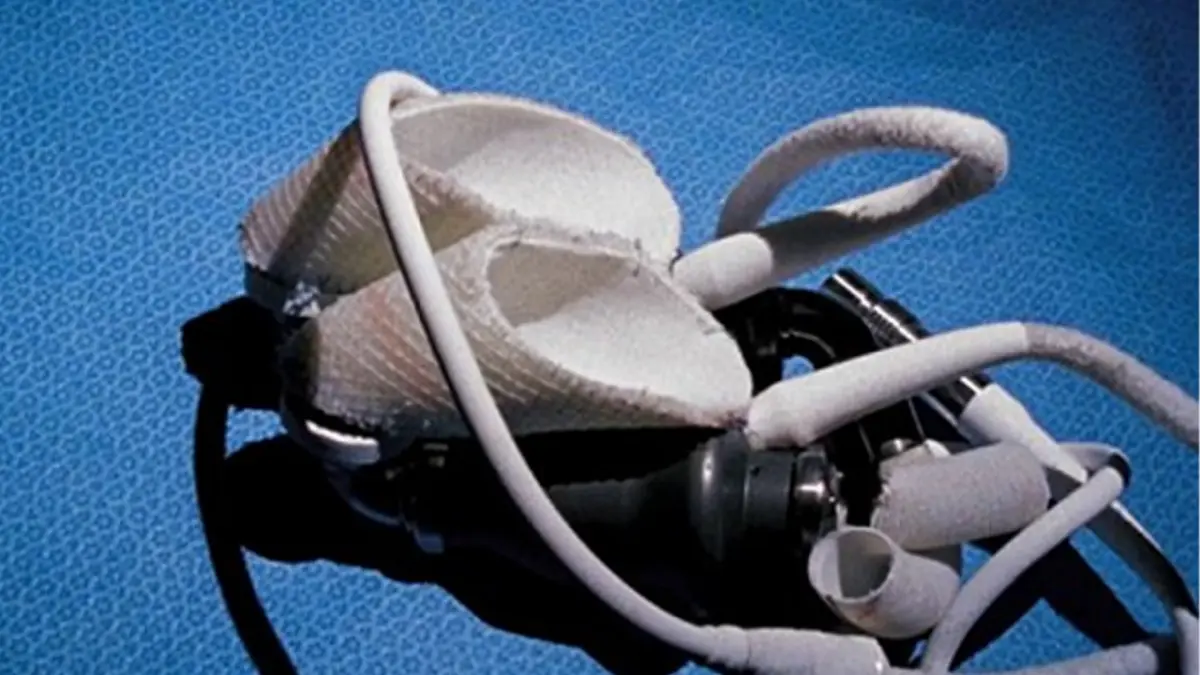 Did you know? ไม่ต้องมีหัวใจก็สามารถมีชีวิตอยู่ได้