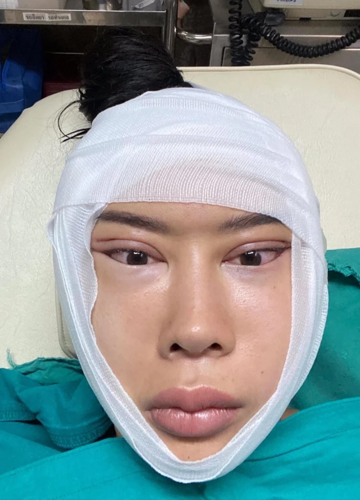 “น้ำเพชร” ทุ่มเงินแสนซ่อมหน้าย้วย ชินโดนแซะบ่อยเสพติดศัลยกรรม