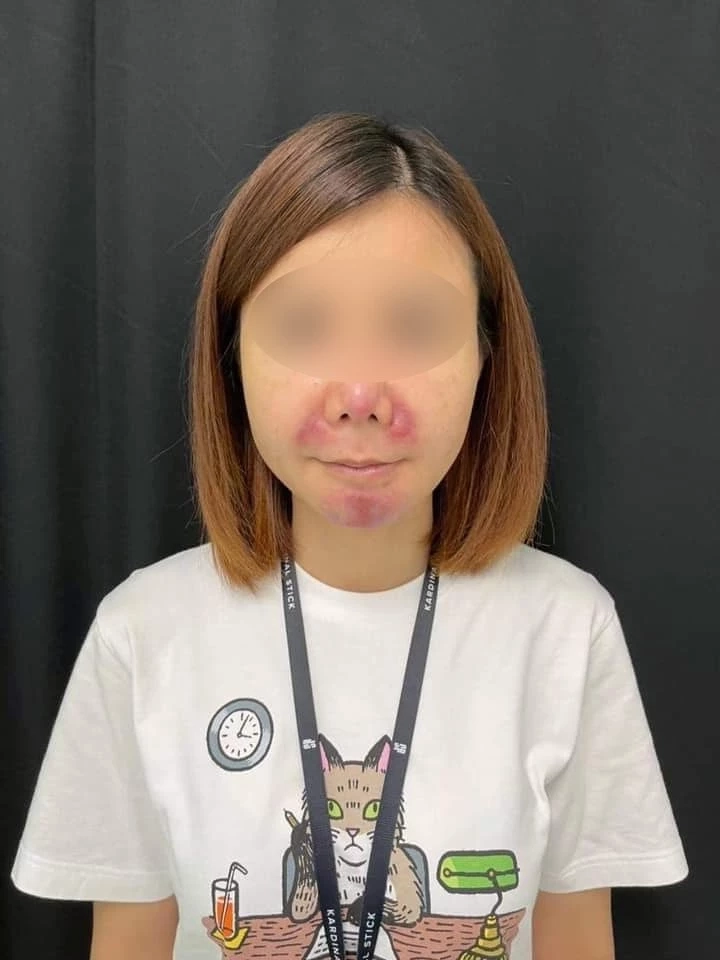 "นิติพลคลินิก" ลั่นเอาผิดสาวแฉหน้าพัง อ้างถูกฉีดฟิลเลอร์ปลอม