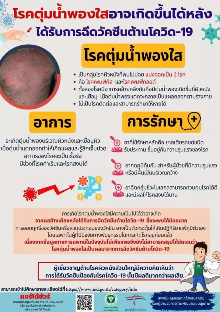 กรมการแพทย์ ชี้ โรคตุ่มน้ำพองใส หลังฉีดวัคซีนโควิด รักษาหายได้