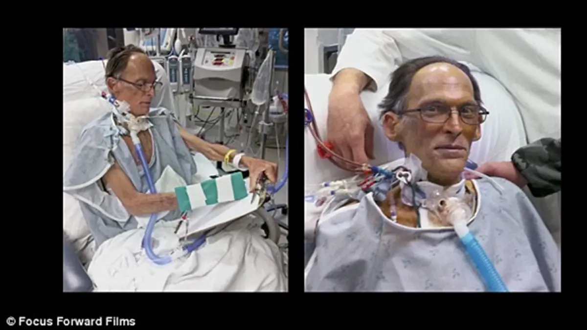 Did you know? ไม่ต้องมีหัวใจก็สามารถมีชีวิตอยู่ได้