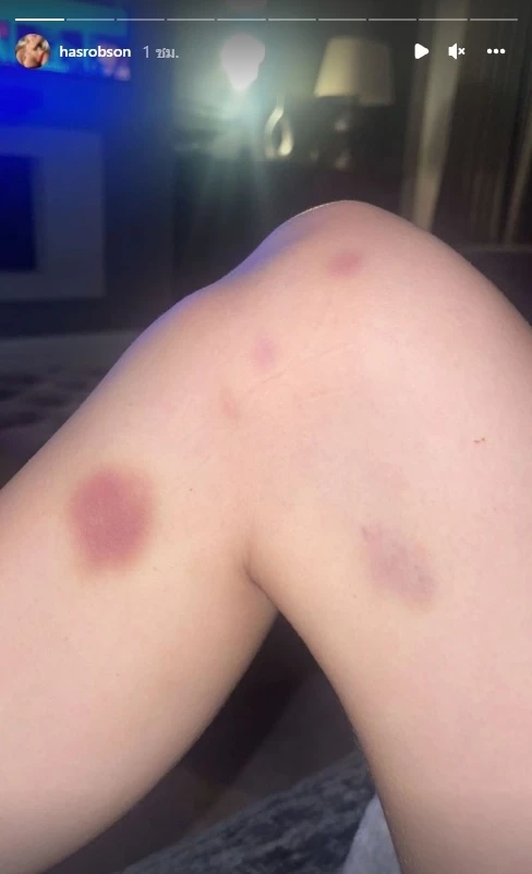 แมนยูแบน "กรีนวูด" ส่อหมดอนาคต หลังถูกแฉหลักฐานทำร้ายอดีตแฟนสาว