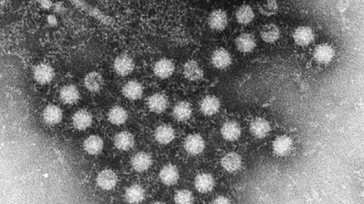 โนโรไวรัส ค้นตอโรคทางเดินอาหาร 