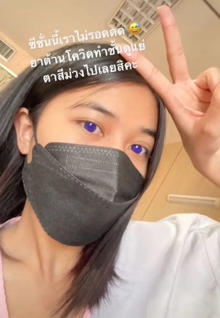 ฮือฮา! สาวโพสต์กินยาฟาวิพิราเวียร์แล้วตากลายเป็นสีม่วง