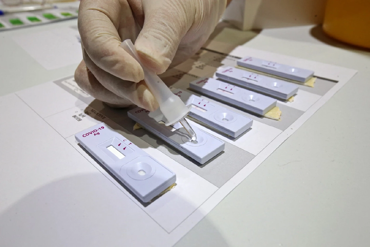 ไทยใกล้วิกฤติระบบสุขภาพ รับผู้ป่วยได้อีกเพียง 1.2 แสนราย