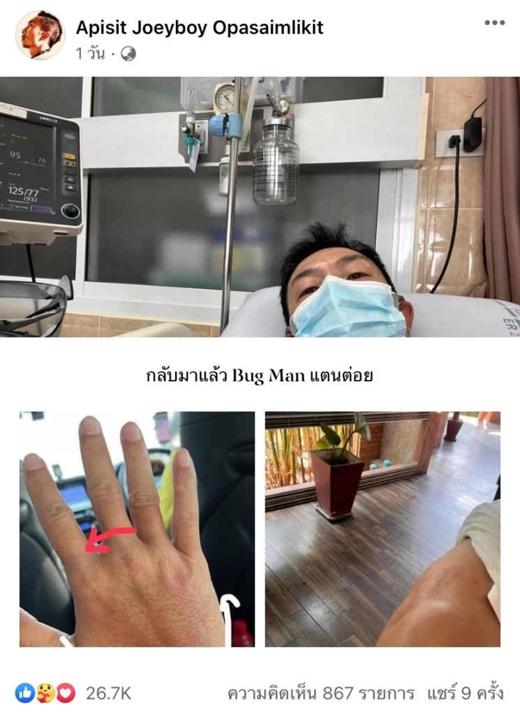 "โจอี้ บอย" หายใจติดขัด แพ้พิษแตนรุนแรง เผยนาทีชีวิตเจ็บปวดจี๊ดถึงสมอง