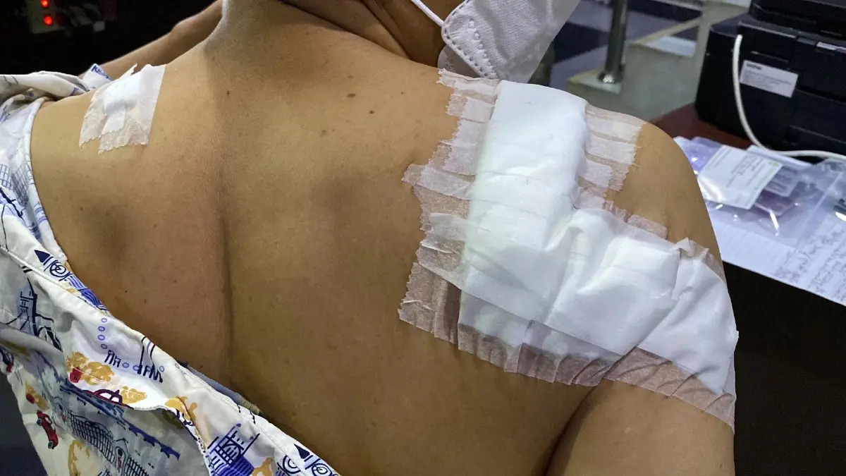 หนุ่มศรีลังกาอ้าง “โดนมนต์ดำ” แค้นคนทำ บุกแทงยับ เย็บเกือบ 30 เข็ม