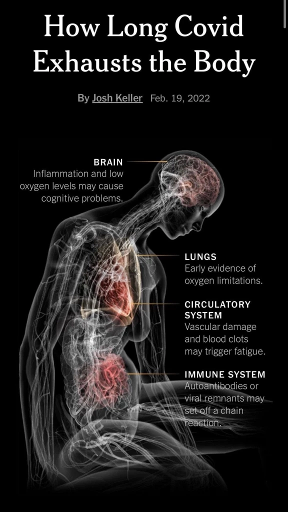 หมอธีระ ชี้ บุคลากรแพทย์ใกล้ภาระล้น ระวังรับไม่ไหว หากควบคุมโรคไม่ดี