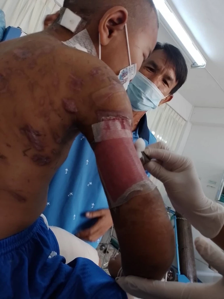 พ่อร้องสื่อร็อตไวเลอร์3ตัวรุมขย้ำลูก9ขวบสาหัส คู่กรณีเบี้ยวเยียวยา