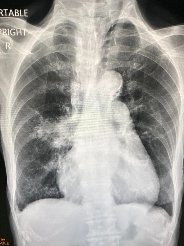 เคสผู้ป่วย