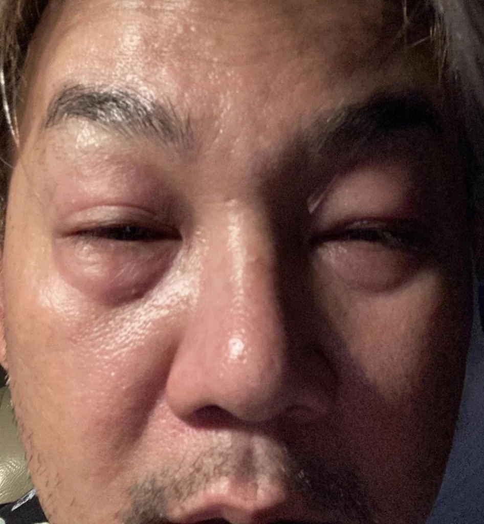 “เอ๊าะ กีรติ” พิธีกรชื่อดัง แอดมิทด่วน ครอบครัวเผยภาพใบหน้า FC สุดห่วงใย