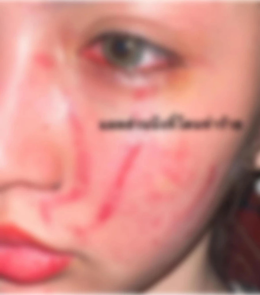 โนอา ภญมณ จิราพัฒนสกุล นักแสดงสาว โพสต์ภาพตัวเองถูกทำร้ายร่างกาย