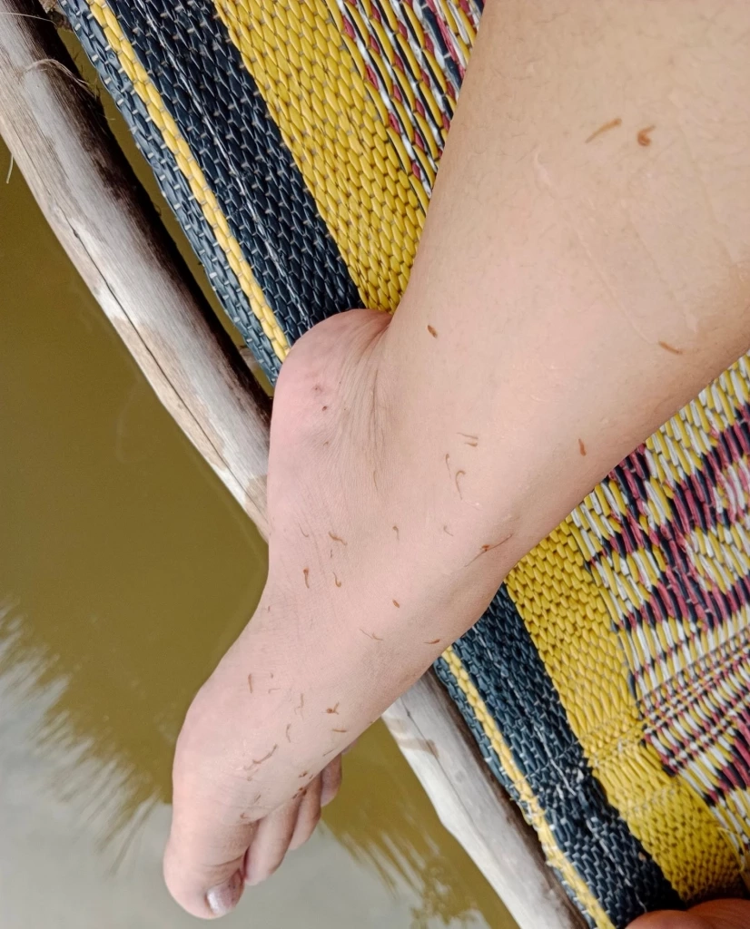 "ห้วยตึงเฒ่า"นำสารส้มไล่หนอนน้ำยันไม่อันตราย