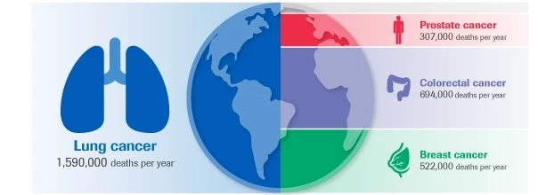 จับสัญญาณ "มะเร็งปอด" โรคร้ายที่คร่าชีวิต "ครูมืด" และคนดังไปมากมาย