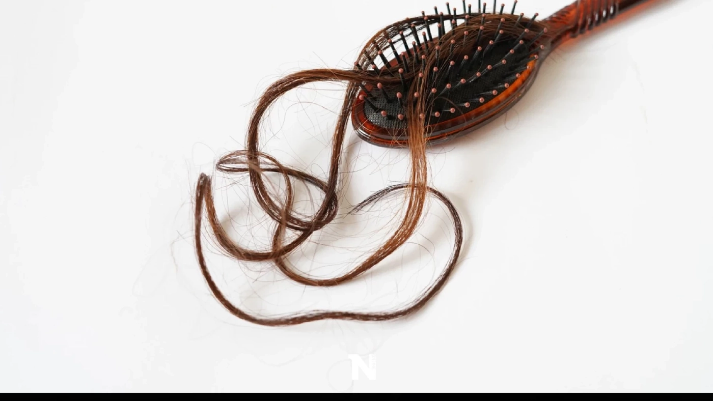 ทำความรู้จัก โรคผมร่วงเป็นหย่อม ภัยร้ายที่คุกคาม ภรรยา วิลล์ สมิธ ในขณะนี้