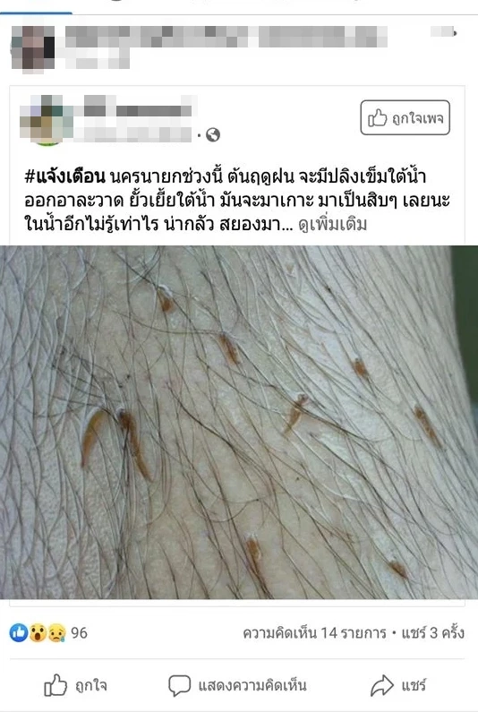 โพสต์แจ้งเตือนปลิงเข็มหรือลูกปลิงควายขณะเล่นน้ำ