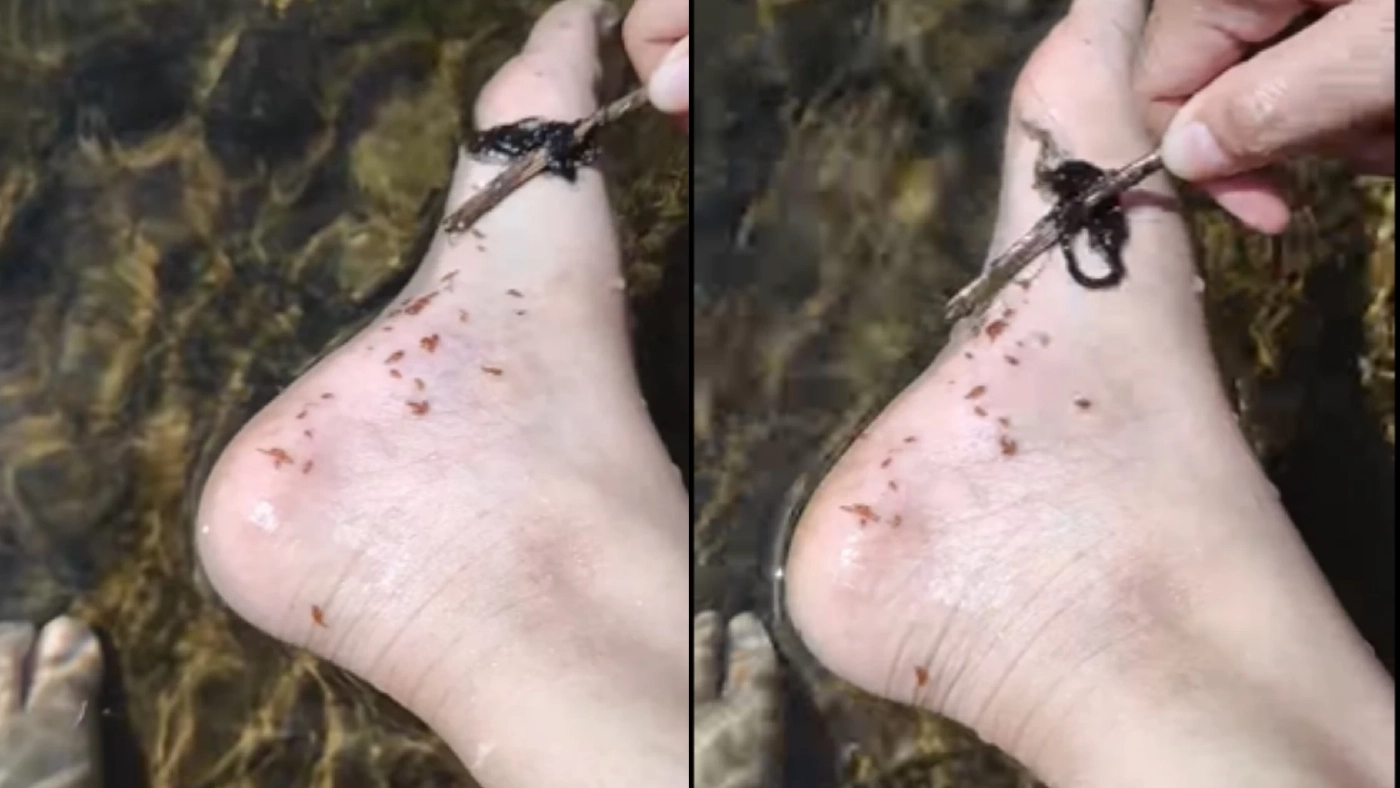 สาวลงเล่นน้ำถูกสิ่งมีชีวิตปริศนาจำนวนมากรุมเกาะ