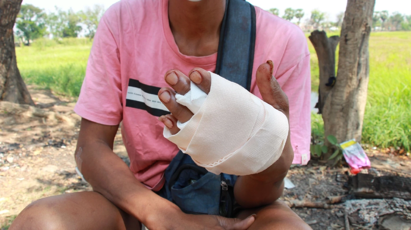 แก๊งโจ๋นับ 10 ควงสปาต้าบุกฟันพนักงานโรงน้ำตาลสาหัส 1