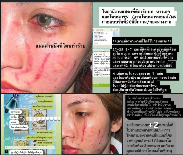 ดราม่าไม่จบ ! คู่กรณี “โนอา” ว่าที่นางเอก เผยชนวนเหตุตบ ชี้เหรียญมีสองด้าน