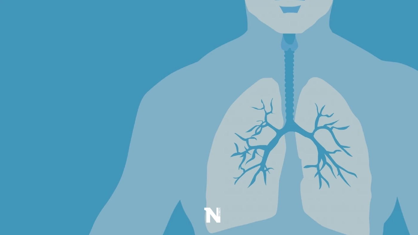 จับสัญญาณ "มะเร็งปอด" โรคร้ายที่คร่าชีวิต "ครูมืด" และคนดังไปมากมาย