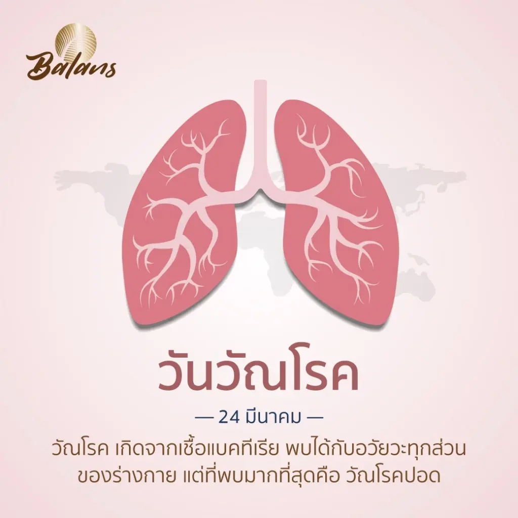 เปิด 5 สัญญาณเตือน "วัณโรค" ใครเป็นรีบหาหมอทันที ก่อนสายไป