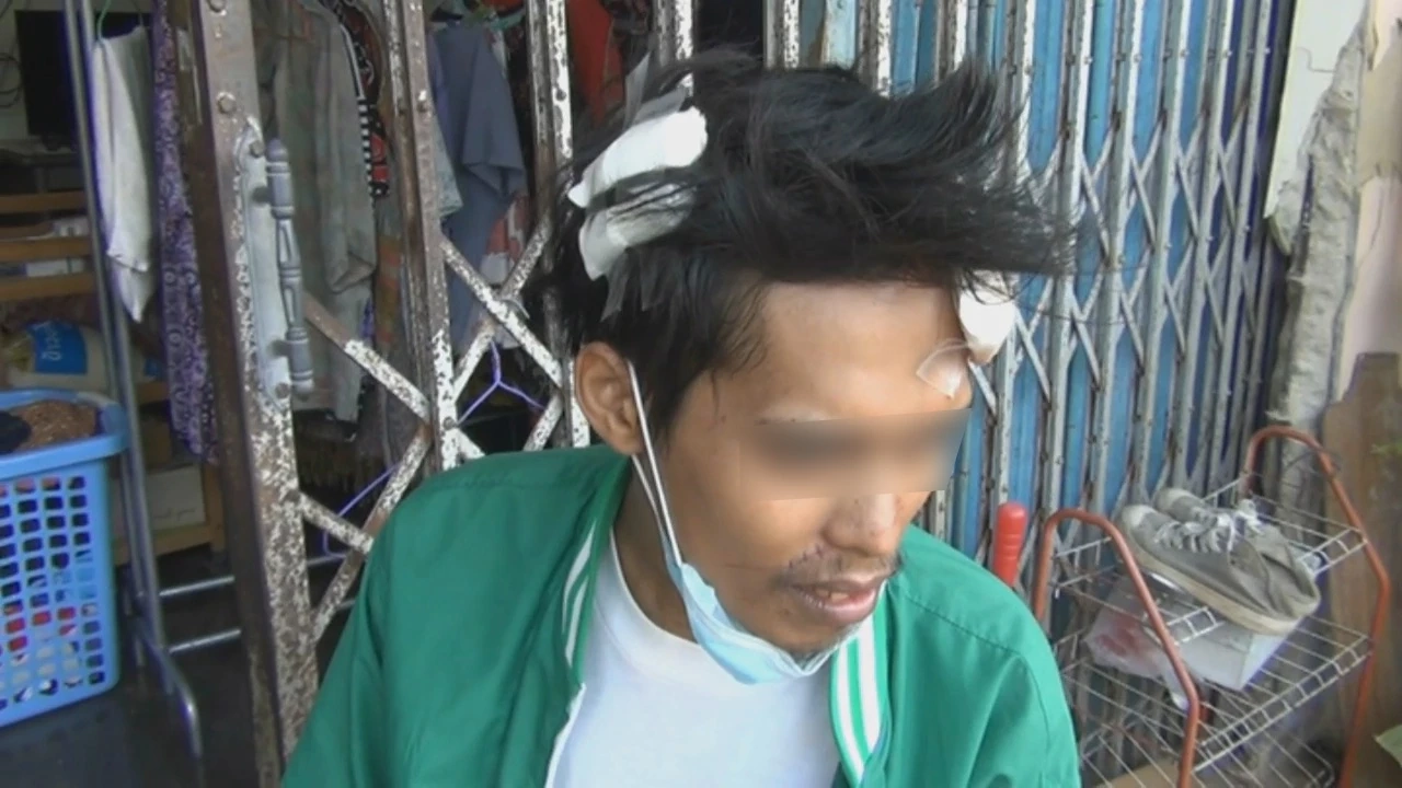 โจ๋หัวร้อนทวงเงิน 120 บ.แทงเพื่อนเจ็บเย็บ 30 เข็ม