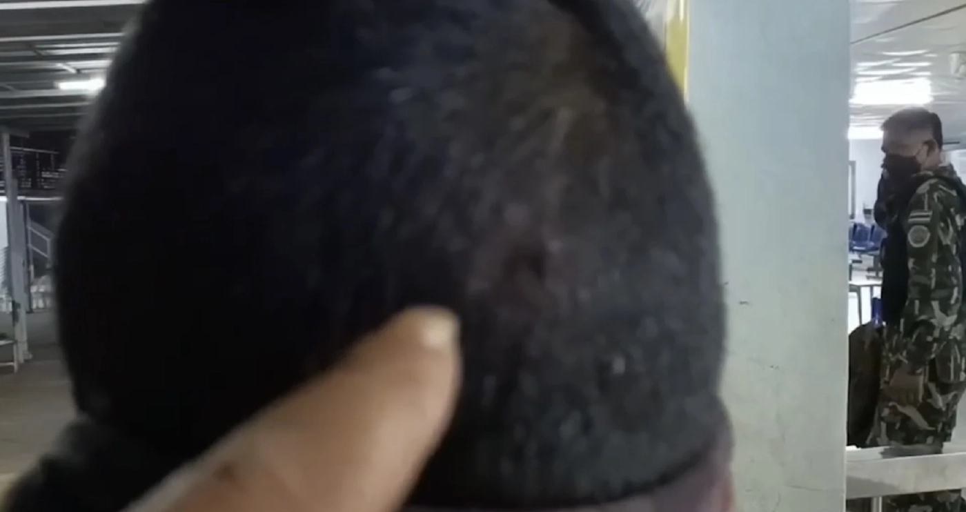 ชาวไทยกระเหรี่ยง นับร้อย ปิดล้อมทำร้ายเจ้าหน้าที่ป่าไม้ ชิงตัวมอดไม้ เจ็บ 3