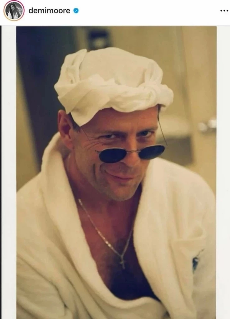 แพทย์แนะนำ ป่วยโรคอะเฟเซีย อย่าวางใจ ควรรีบพบแพทย์ทันที