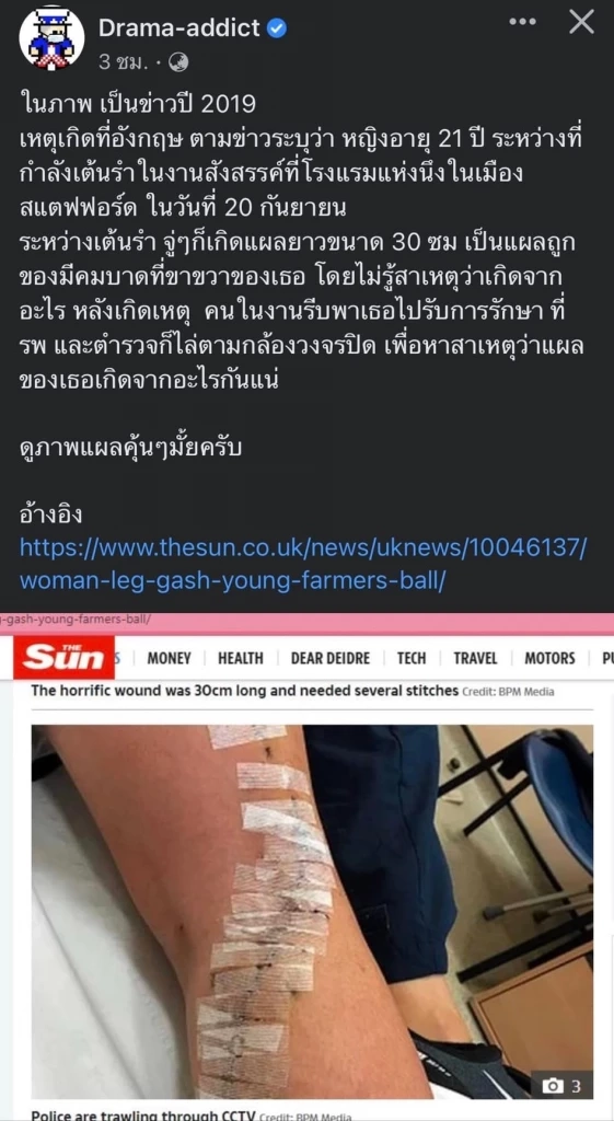 โซเชียลจับโป๊ะ “ตำรวจ” เทียบภาพแผลคดีแตงโม ยกเคสตปท.เหมือนตรงไหน ?