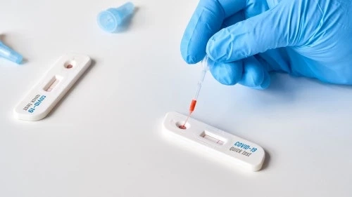 เช็กชัวร์ หากพบ 3 อาการนี้ คุณมีความเสี่ยง “ติดโควิดโอมิครอน”