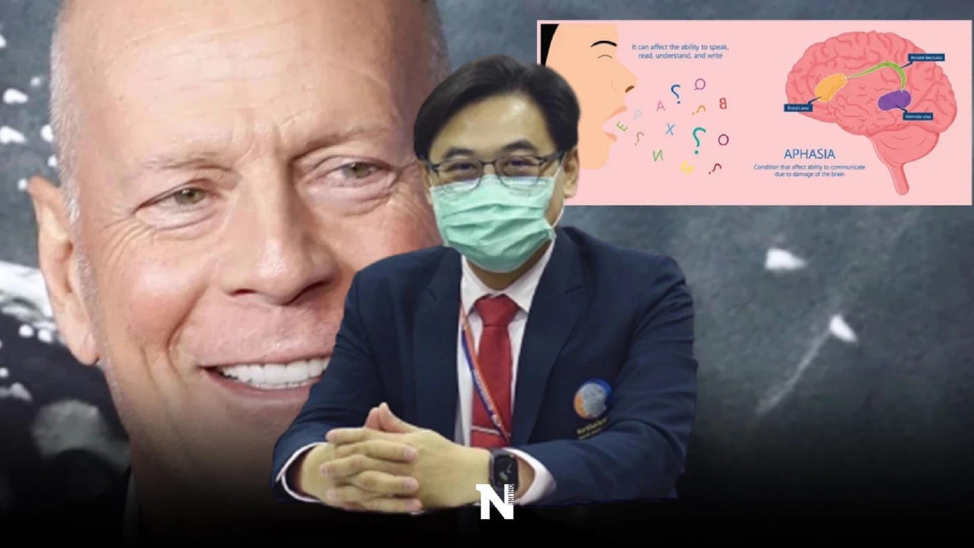 แพทย์แนะนำ ป่วยโรคอะเฟเซีย อย่าวางใจ ควรรีบพบแพทย์ทันที