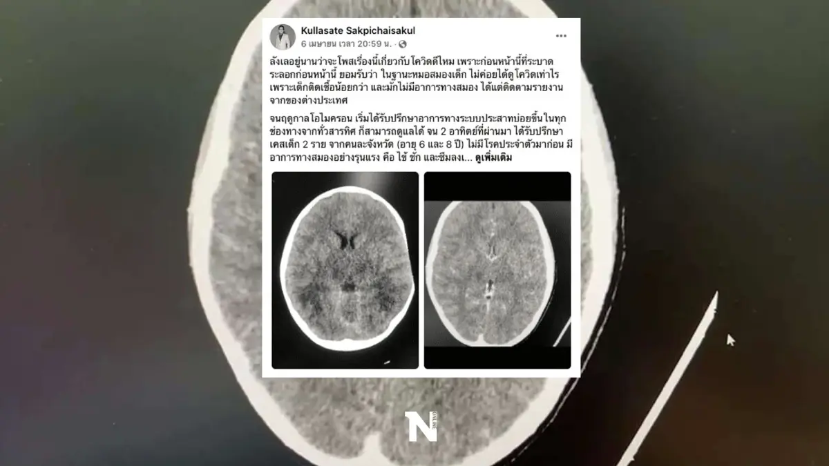แพทย์แนะนำ สังเกตอาการเด็กติดโควิด แม้ไม่มีโรคประจำตัว สุดท้ายเสียชีวิต
