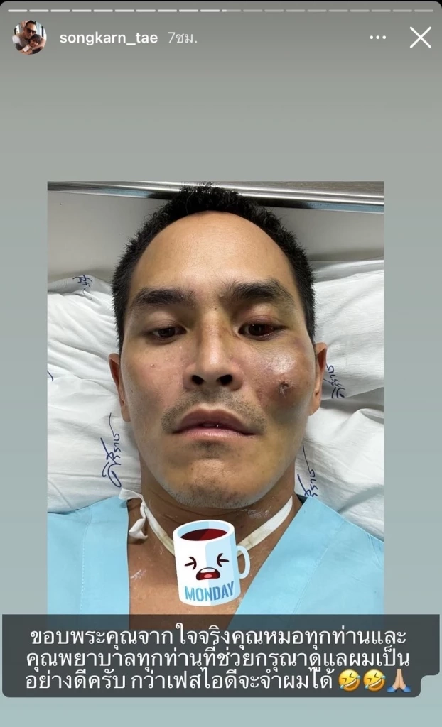 "สงกรานต์ เตชะณรงค์"  เข้าICU นาน7วัน ล่าสุดออกมาเคลื่อนไหวแล้ว