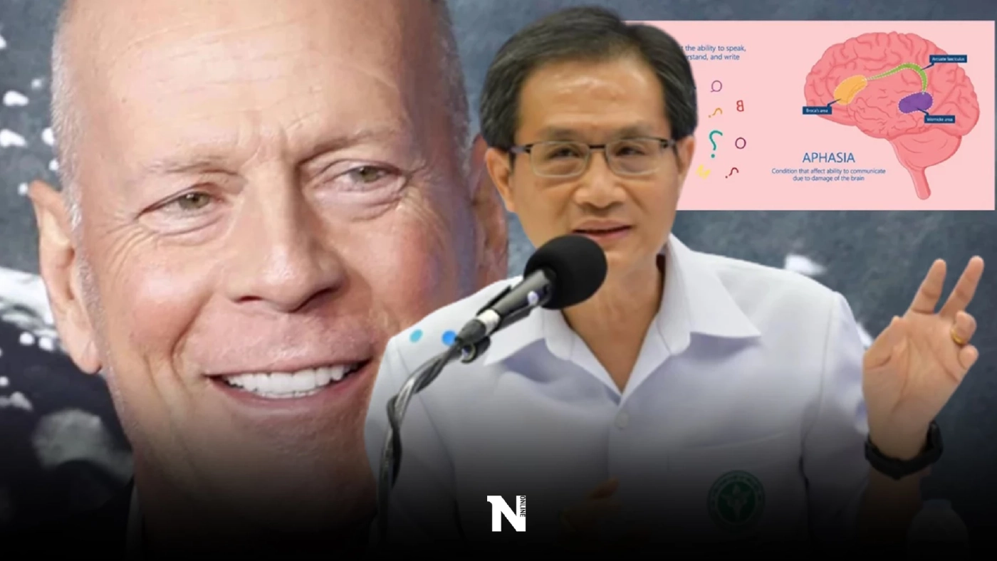 แพทย์แนะนำ ป่วยโรคอะเฟเซีย อย่าวางใจ ควรรีบพบแพทย์ทันที