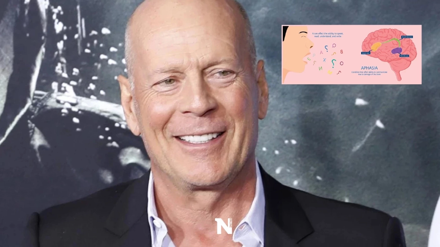 แพทย์แนะนำ ป่วยโรคอะเฟเซีย อย่าวางใจ ควรรีบพบแพทย์ทันที