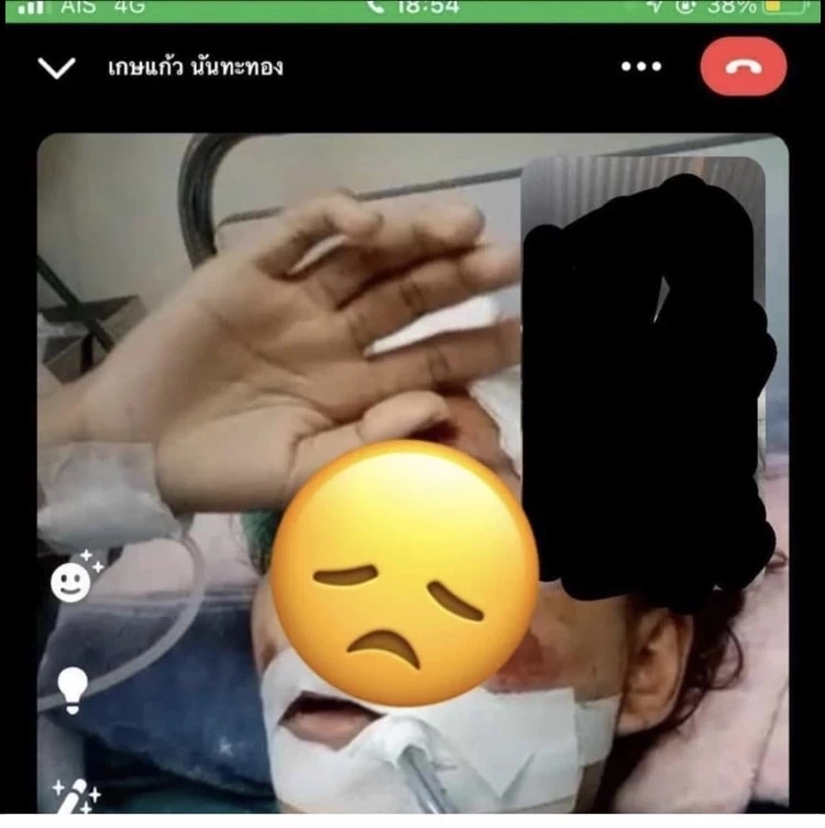 สุดช็อก "น้องอากี้" มิสแกรนด์หนองคาย 2020 ประสบอุบัติเหตุรถชน อาการสาหัส